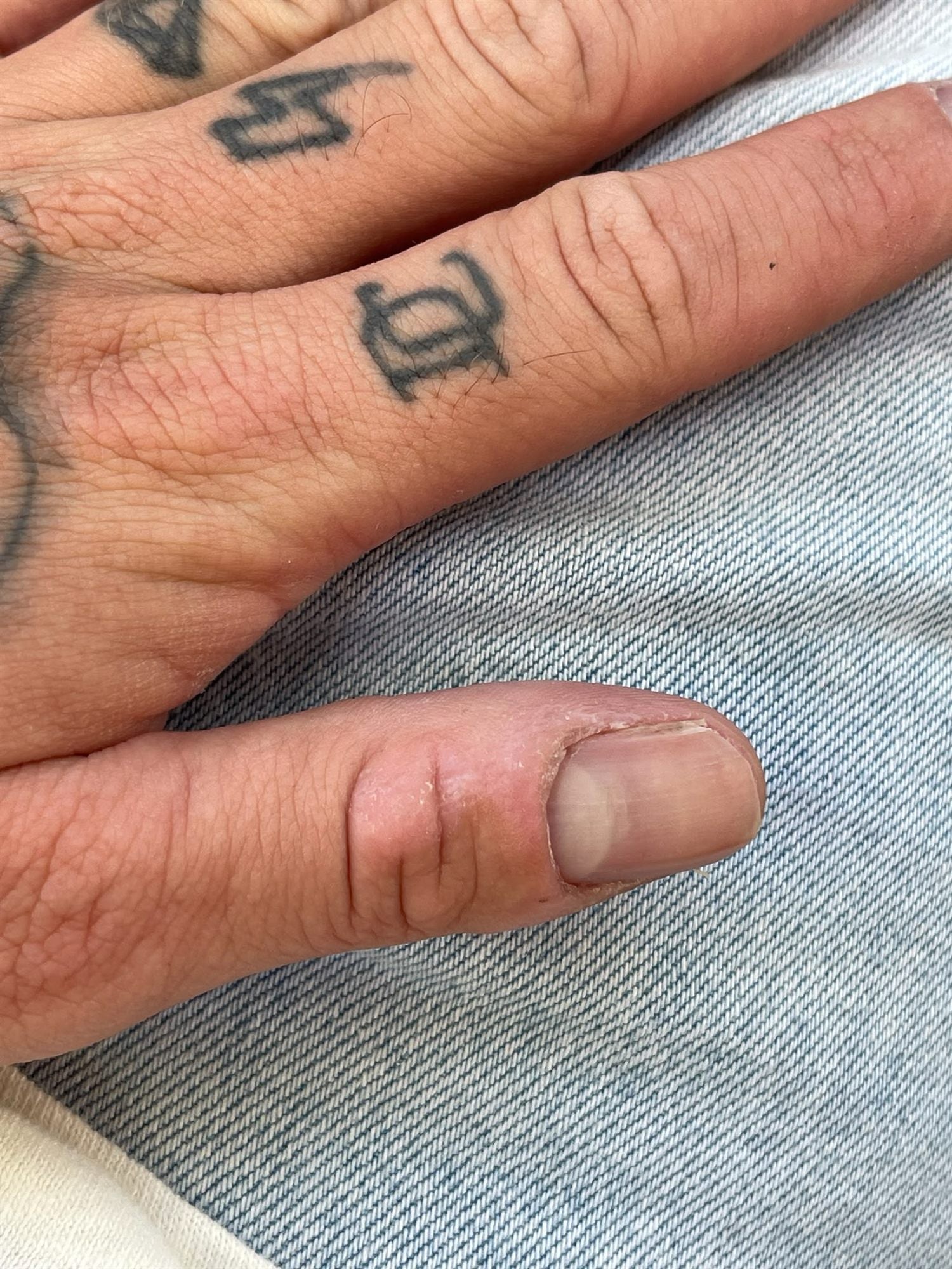 A tattooed hand resting on denim, thumbnail bitten short and the cuticle worn